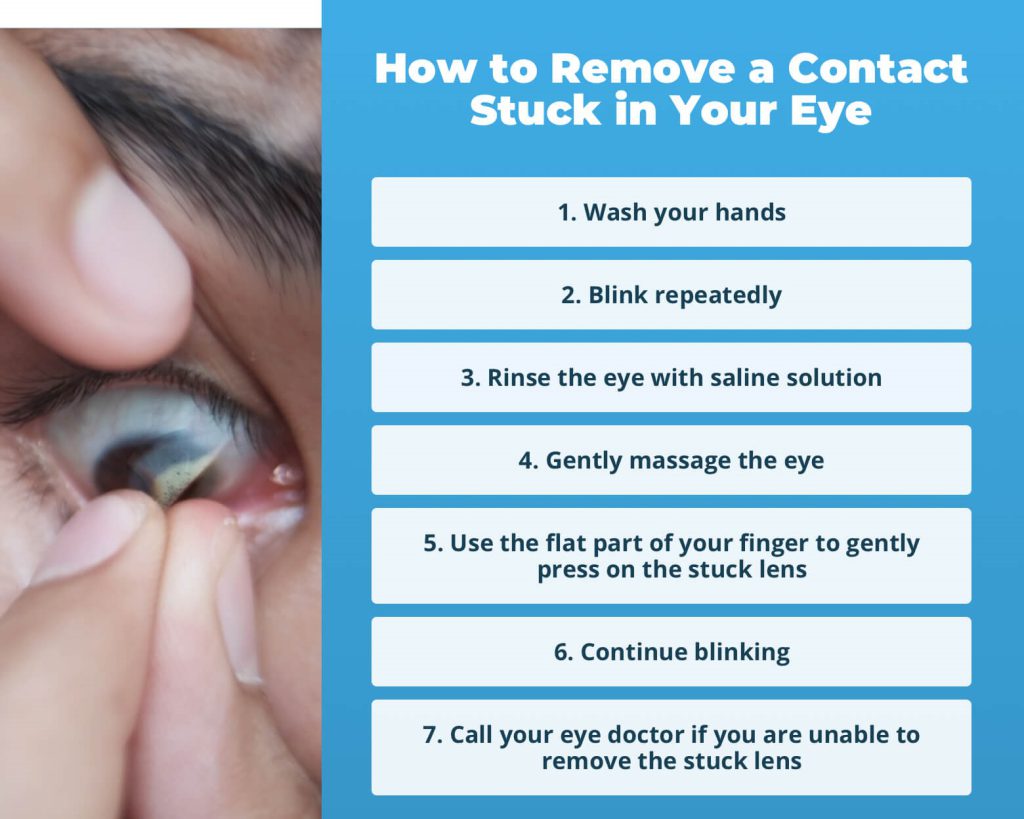 مراحل درآوردن لنز تماسی طبی و رنگی از چشم