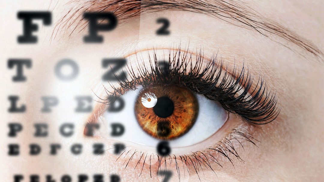 مشاوره با چشم پزشک یا بینایی سنج (اپتومتریست) برای انتخاب لنز رنگی مناسب